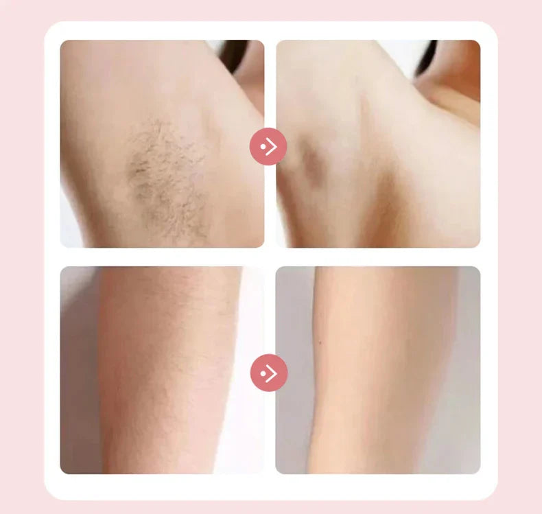 SmoothShave | Dites adieu aux irritations dues au rasage et bonjour au rasage en douceur.